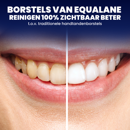 Opzetborstels geschikt voor Oral B iO tandenborstels - Zachte Borstelharen - Zwart - 8 Stuks